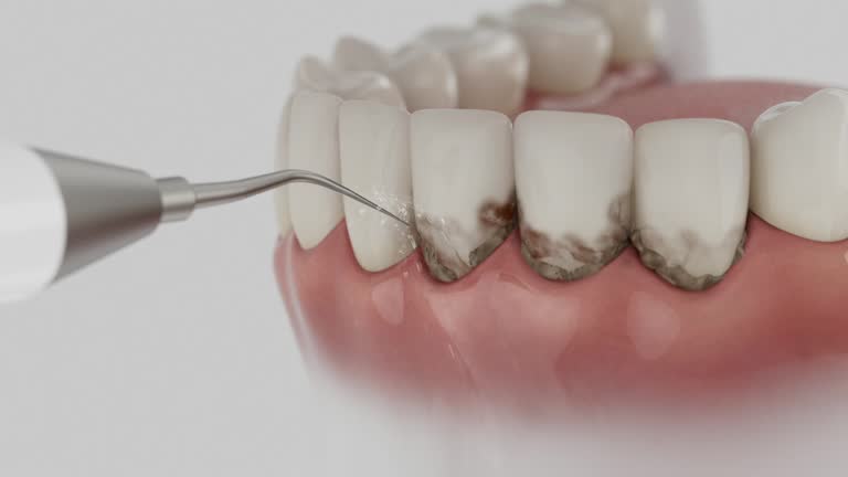 Trusted Teeth Cleaning And Checkup service in Fairview, TX - Dentist Open Now